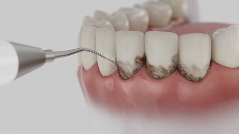 Reliable Tooth Extraction contractor in Charles County County, MD by Dentist Open Now
